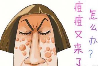 痤疮产生的具体原因